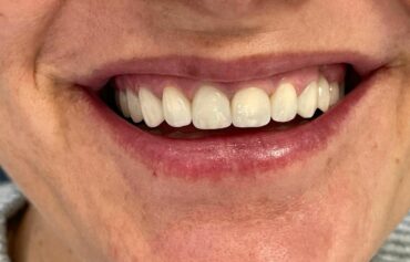 Cosmetic Dentistry