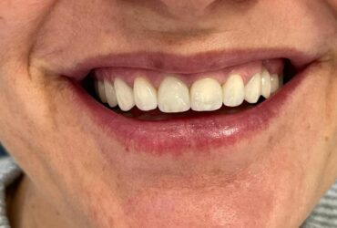 Cosmetic Dentistry